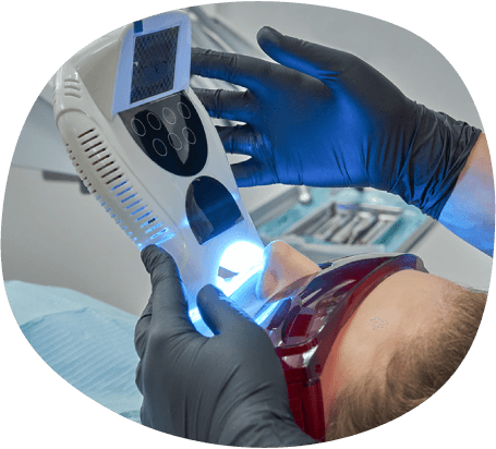 オフィスホワイトニングの様子