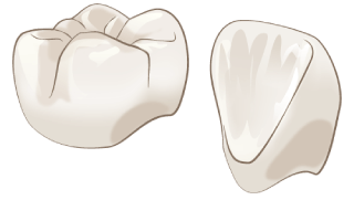 フルジルコニア クラウン